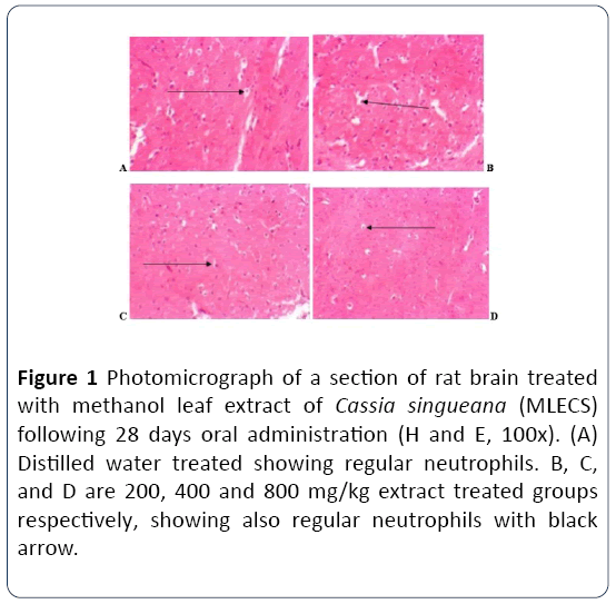 herbal-medicine-brain-treated